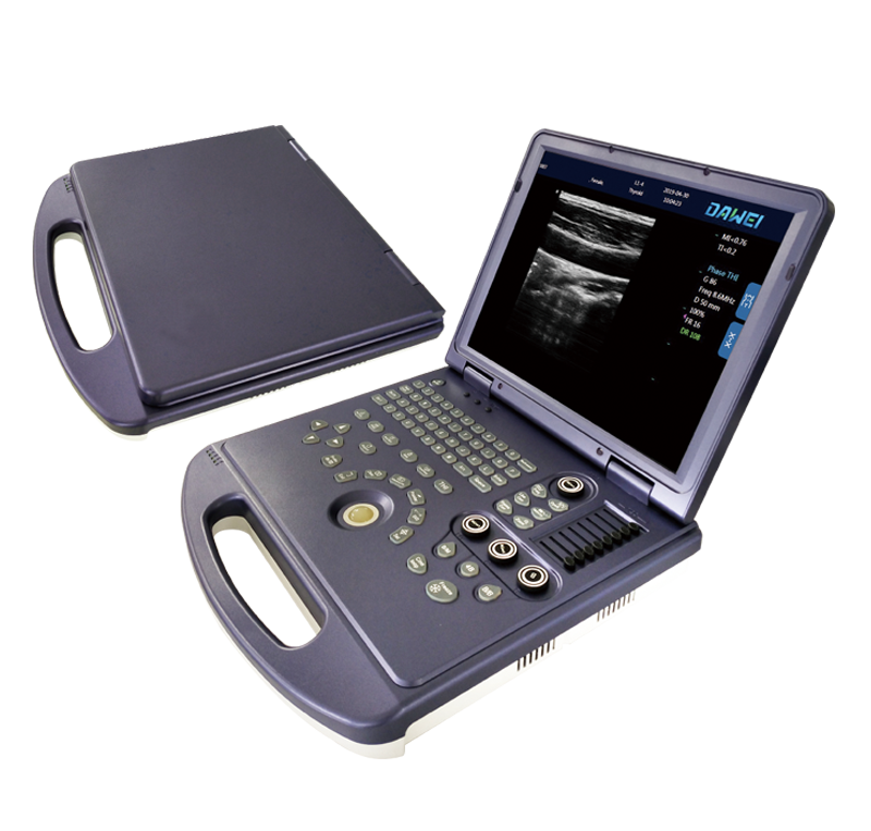 DW-360便攜式B超機(jī)